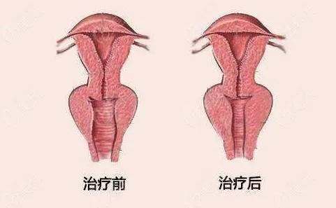 揭秘私密保养背后的风险：一位年轻女性的美丽代价